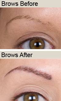 Redeem Semi permanent makeup and Tattoo removal, Whitby 379657 Image 8